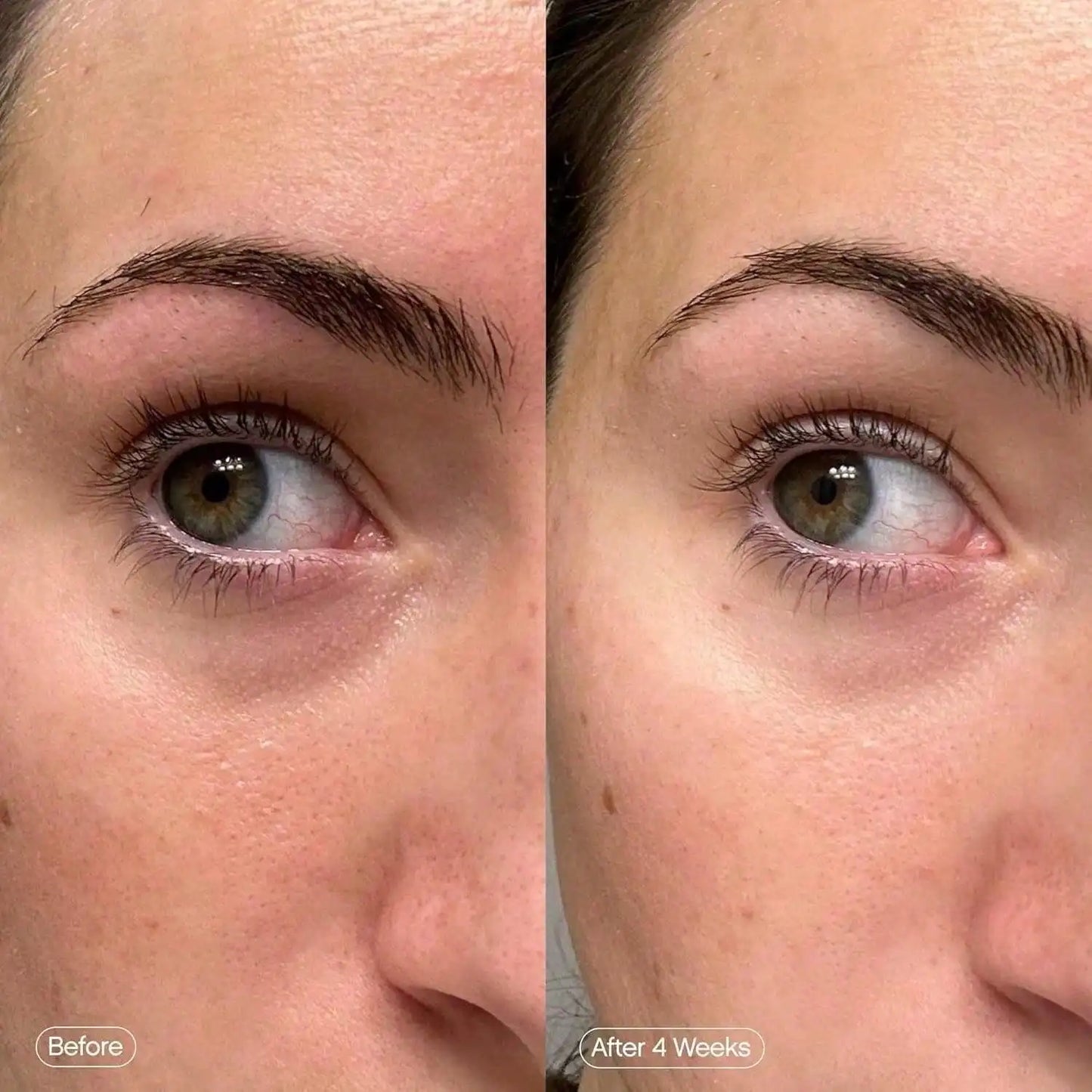 Brighten & Hydrate Under Eye Patches